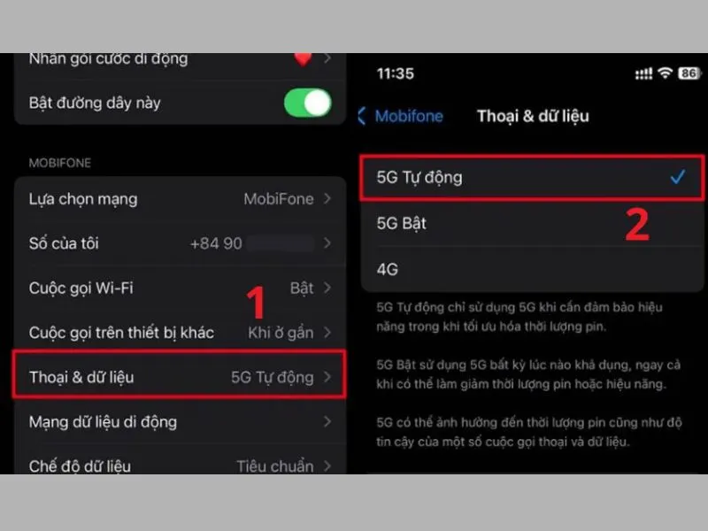 sim hỗ trợ 5g