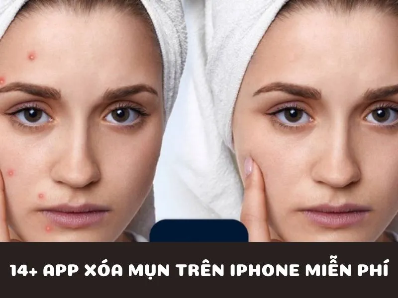 Top 14+ app xóa mụn trên iphone miễn phí