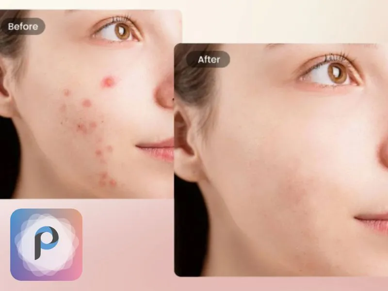 app xóa mụn trên iPhone miễn phí Fotogenic